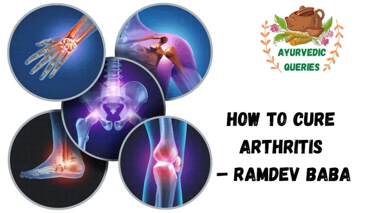 How to cure Arthritis by Yoga Baba Ramdev guide) Ayurvedic Queries